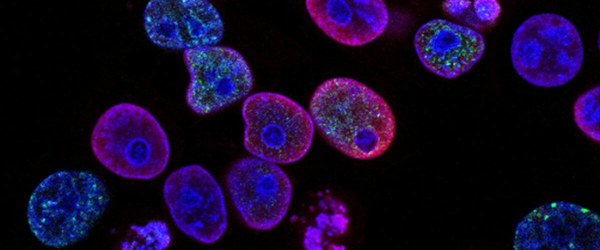 purple cells