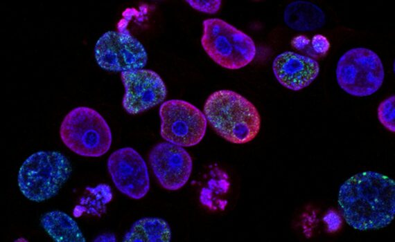purple cells